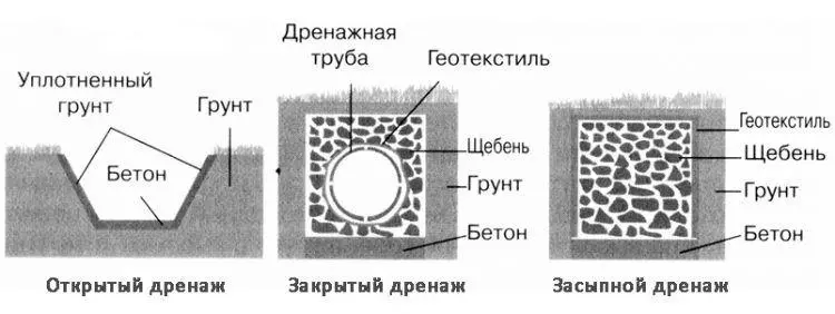 Виды дренажа